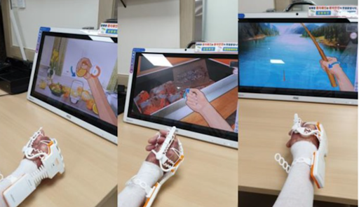 VR-based hand burn rehabilitation system